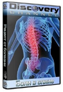Рецепт от болезни: Боли в спине / The body invaders. Backache (2000/DVDRip)