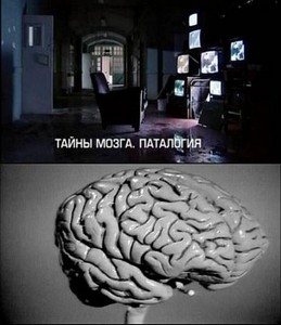 Тайны мозга. Патология (2011) DVB