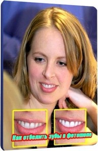 Как отбелить зубы в фотошопе (2011) SATRip