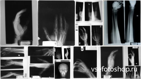 X-Rays Textures 4 JPG Files